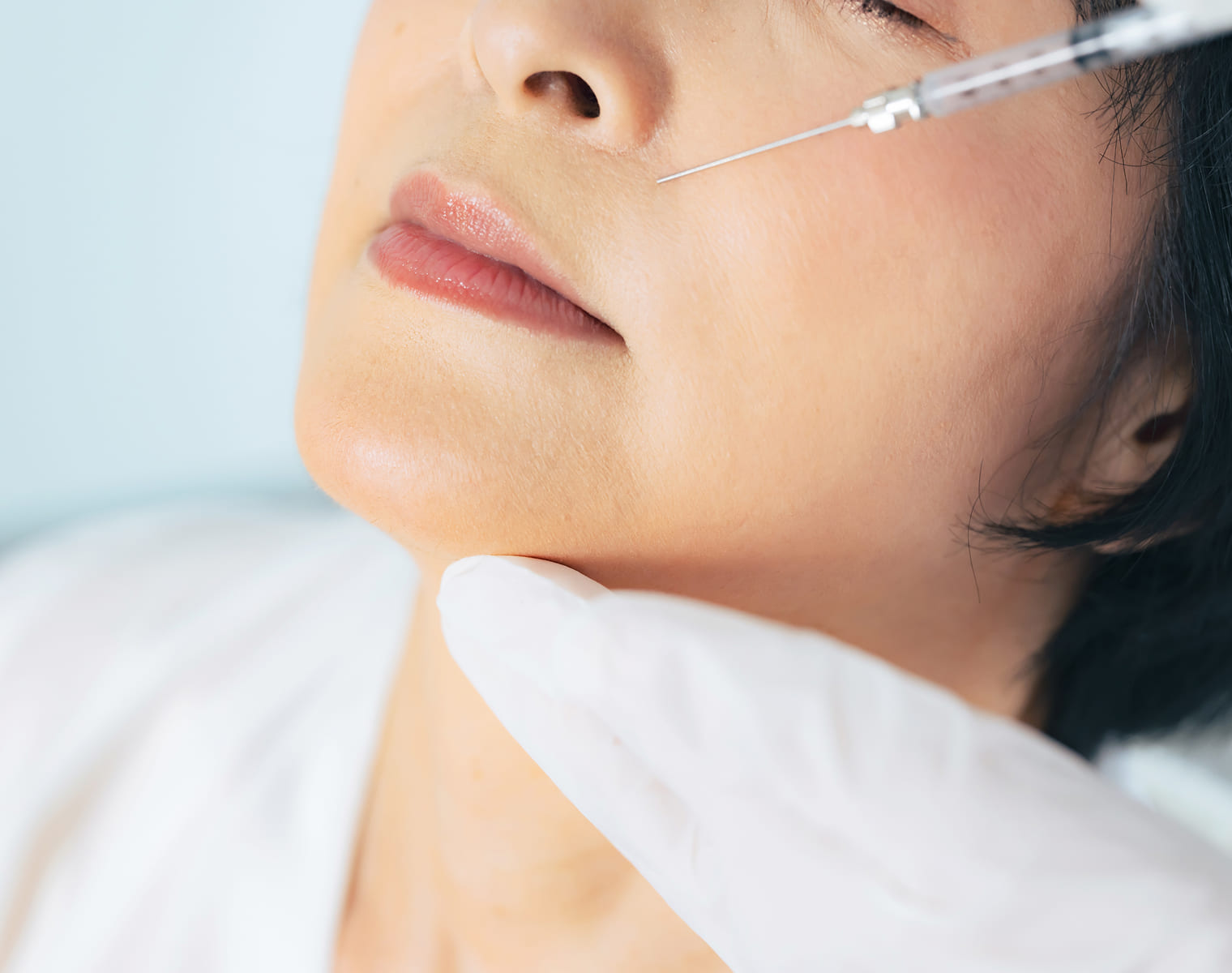 Nasolabial Line Fillers in Basingstoke