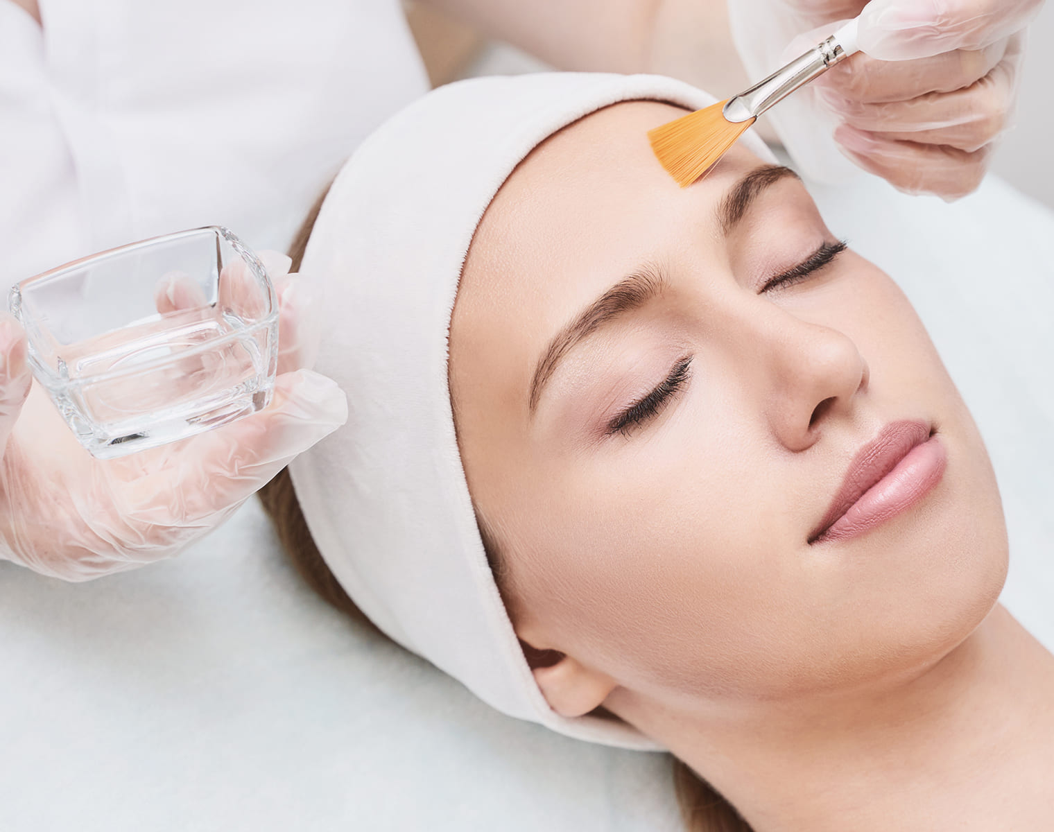 Chemical Skin Peels in Basingstoke