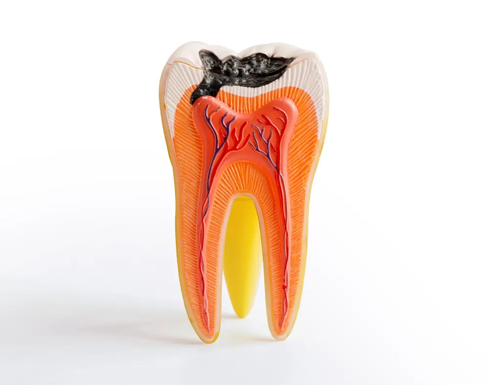 A detailed cross-section model of a tooth showing the outer enamel, inner dentin, pulp chamber with nerves and blood vessels, and the root extending downward.