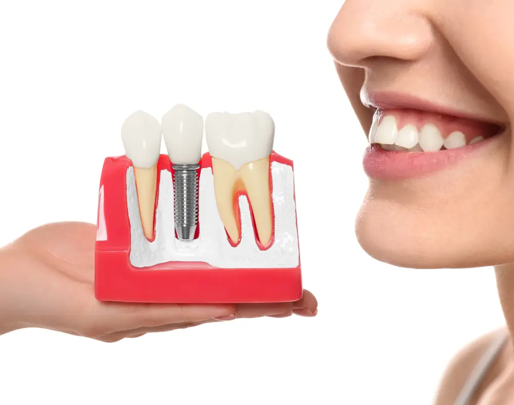 A woman smiling while holding a dental model showing a dental implant, adjacent teeth, and gum tissue in close-up.