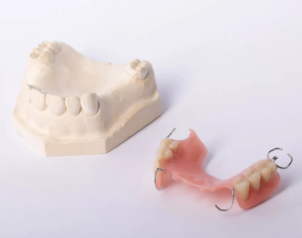 Dental mold and denture with metal hooks on a white background.