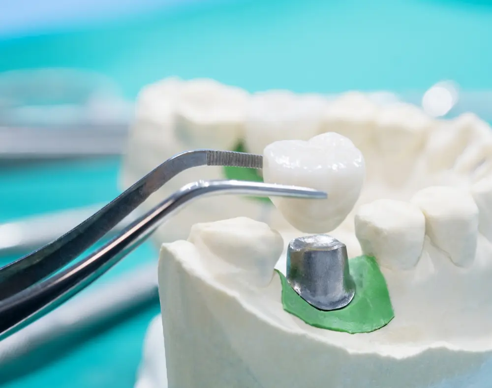 A dental model showing a tooth being prepared with a dental mirror and a temporary crown, with additional teeth and dental tools in the background.