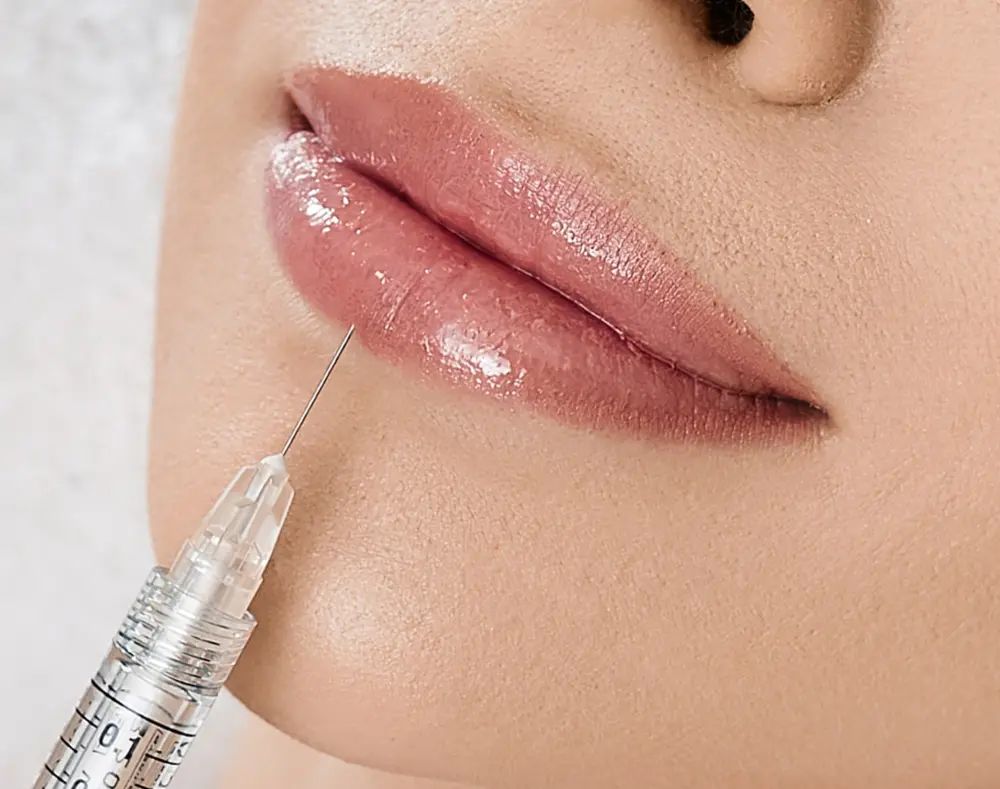 Close-up of a woman's lips being injected with lip filler from a syringe, highlighting smooth, plump lips and the medical procedure.