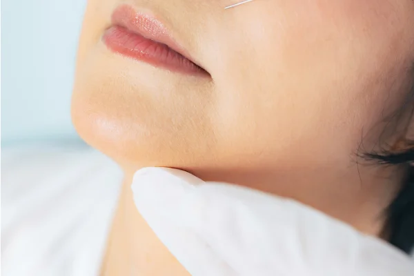 A person receiving a cosmetic injection near the nose, with a healthcare professional holding their chin, close-up of the face and needle.