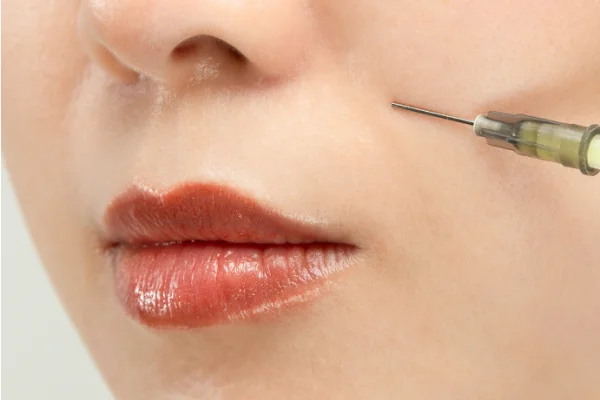 Close-up of a person's lips and nose with a syringe near their cheek, suggesting a cosmetic or medical procedure taking place.