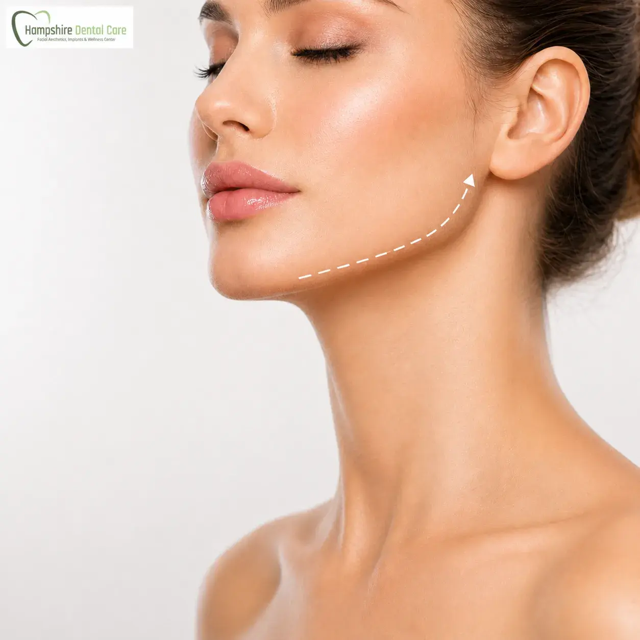 Biofiller facial rejuvenation consultation at Hampshire Dental Care