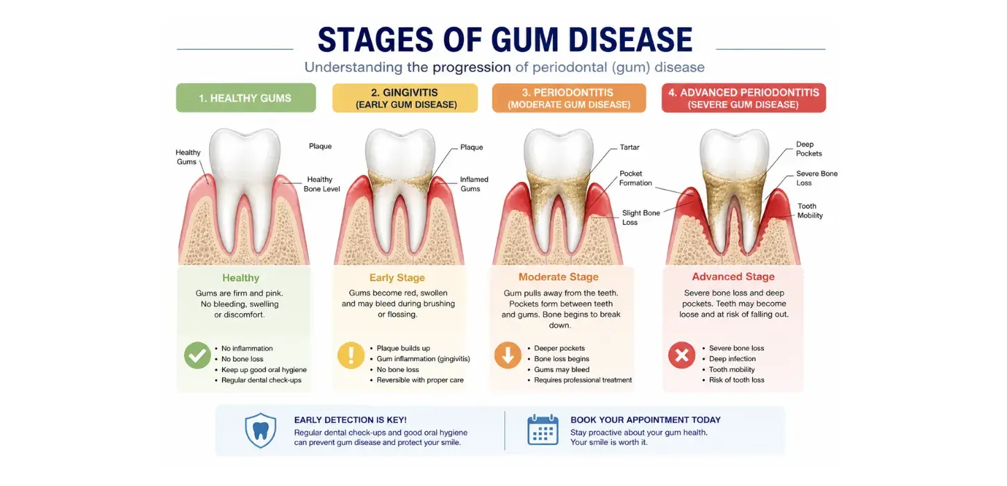 Can Gum Disease Be Reversed? Gingivitis & Periodontitis Explained