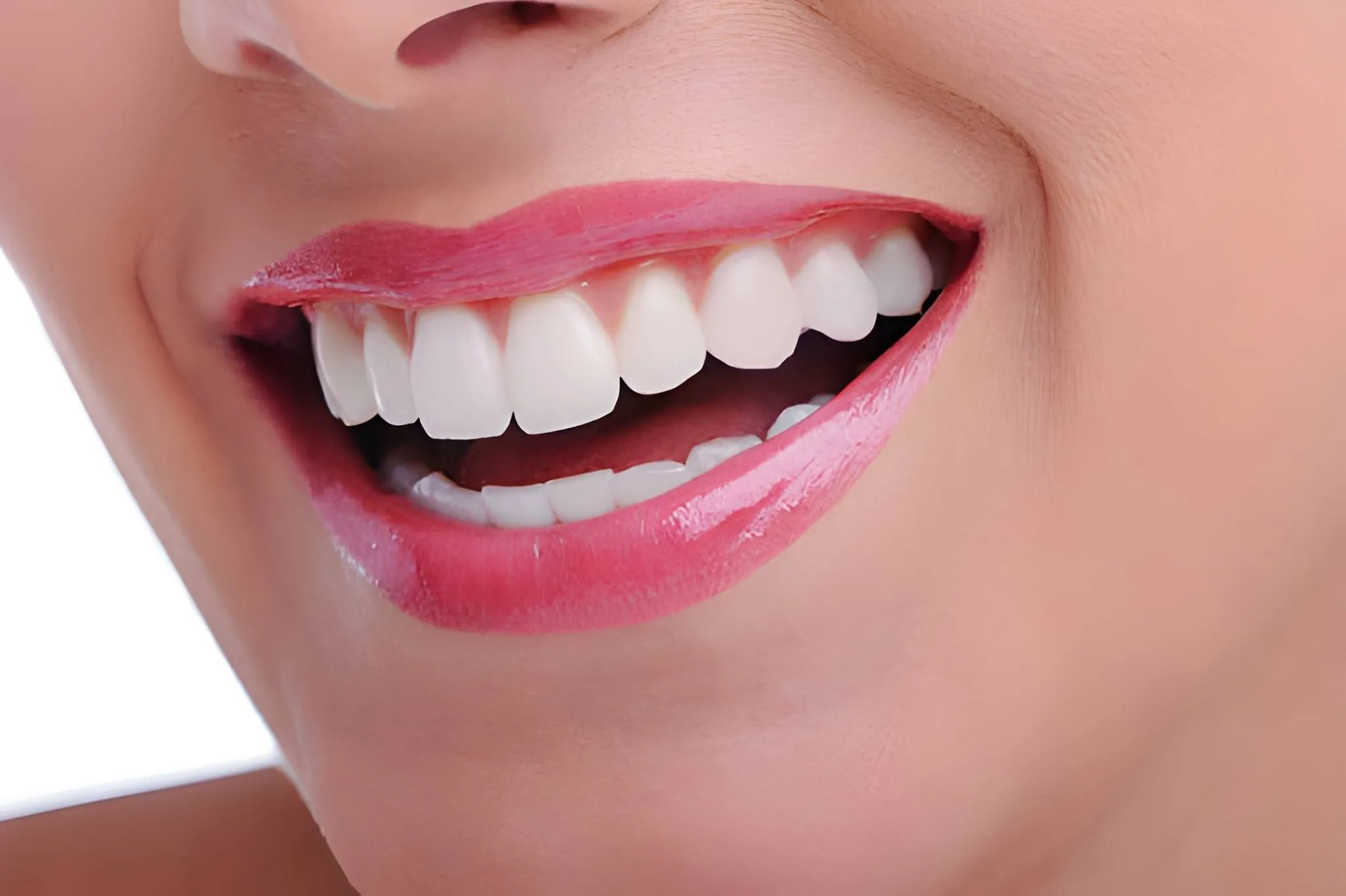 Gum Contouring & Reshaping