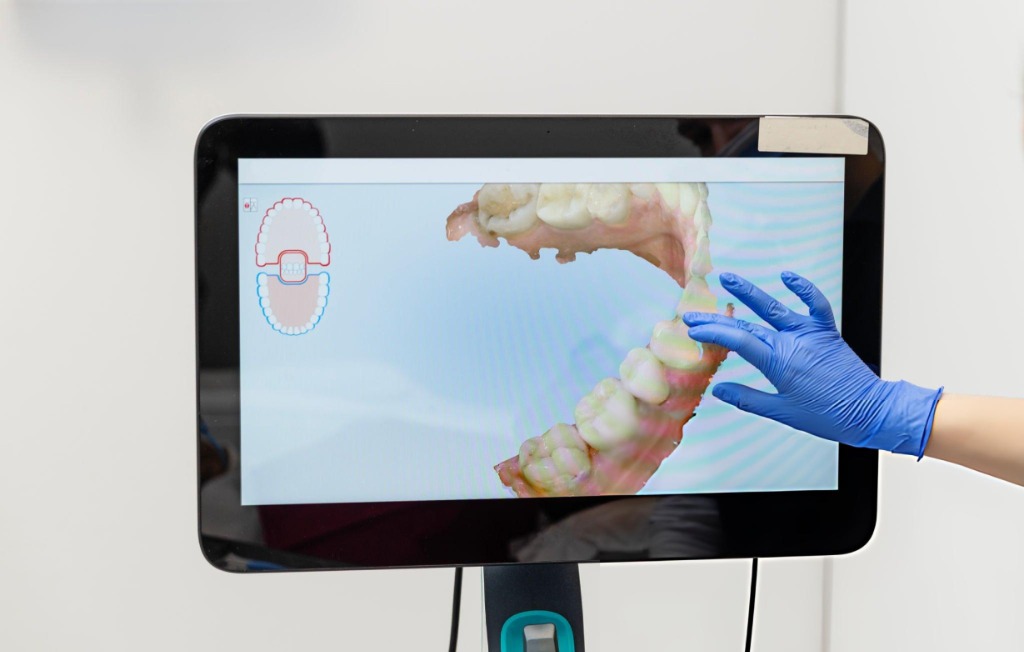 What Causes Teeth to Wear Down?
